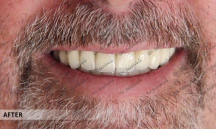 smile design dentistry