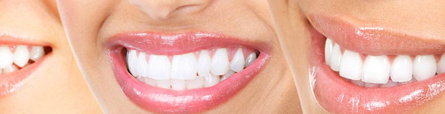 Smile Design Dentistry – Your Complete Smile Dental Solution