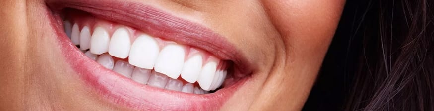 4 Benefits of Full Mouth Reconstruction