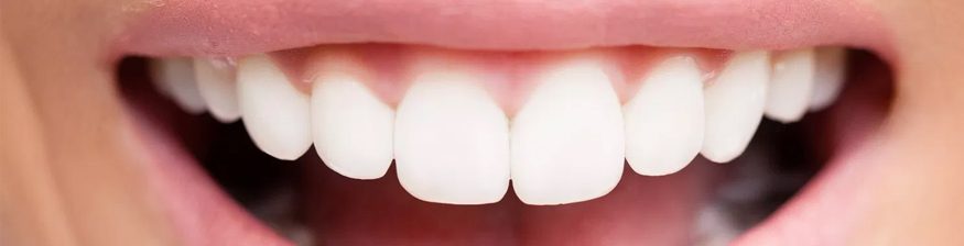 Benefits of Full Mouth Restoration