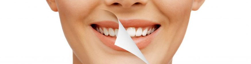 How Can a Teeth Makeover Improve Your Life?