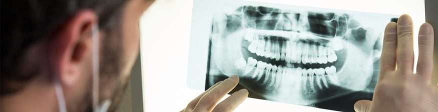 The importance of dental xrays