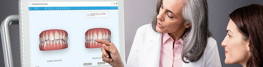 Dental Implant Consultation – What To Expect?