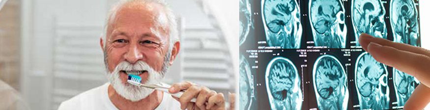 Teeth and Memory: Unraveling the Alzheimer’s Connection