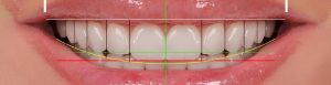 AI in Dentistry: Designing Perfect Smiles