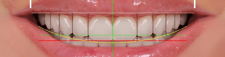 AI in Dentistry: Designing Perfect Smiles