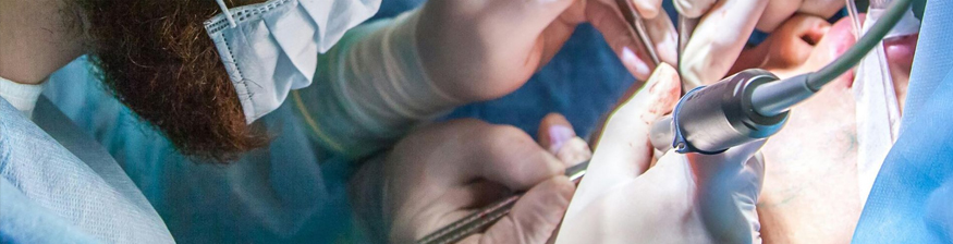 The Great Bone Graft Robbery: How I Wasted $8,000 on This Procedure