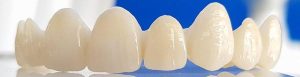 Could Future Zirconia Integrate With Your Gum Tissue?