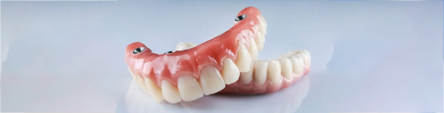 From Dentures to Permanent Implants at 70 in India