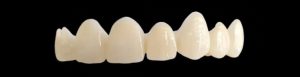Is Zirconia the ‘Tesla’ of Dental Crowns? - Hype vs. Reality